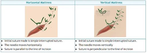 mattress sutures used in wound approximation