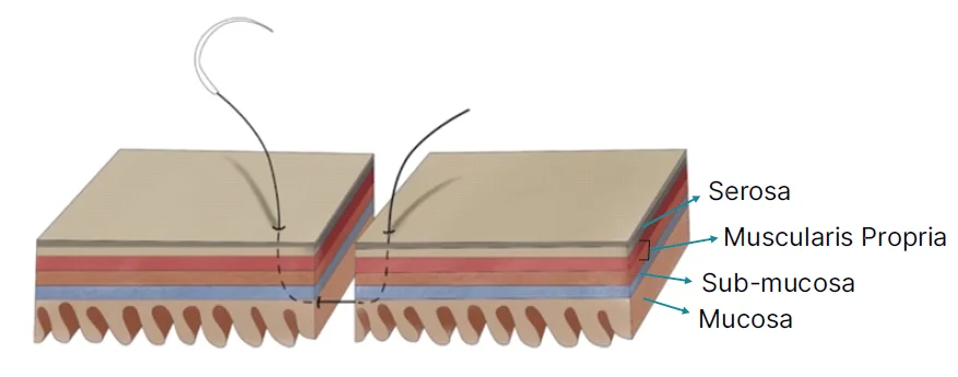 principles of bowel anastomosis