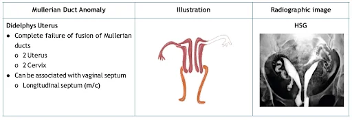 Types of Müllerian duct anomalies