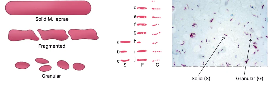types of bacteria