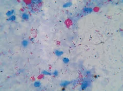 Bacteriological Index (BI) 2
