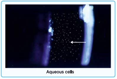keratin proteins, Aqueous Cells 