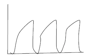 ETCO₂ line