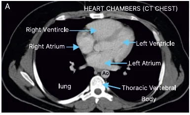 heart chambers