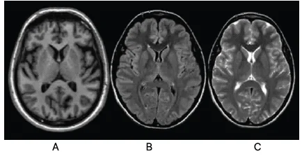 T1, T2, and FLAIR MRI sequences