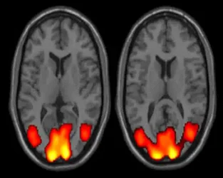BOLD/fMRI