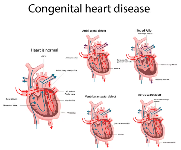 pediatric cardiology