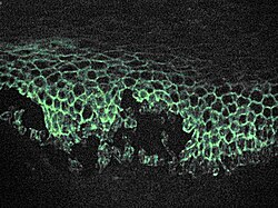 Microscopic image of direct immunofluorescence using an anti-IgG antibody