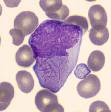 The Hematology Loop for NEET Pg relevance