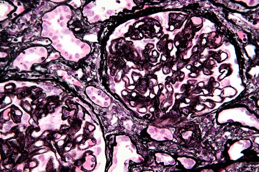 The Renal Loop- From Microscopy to Management (1)