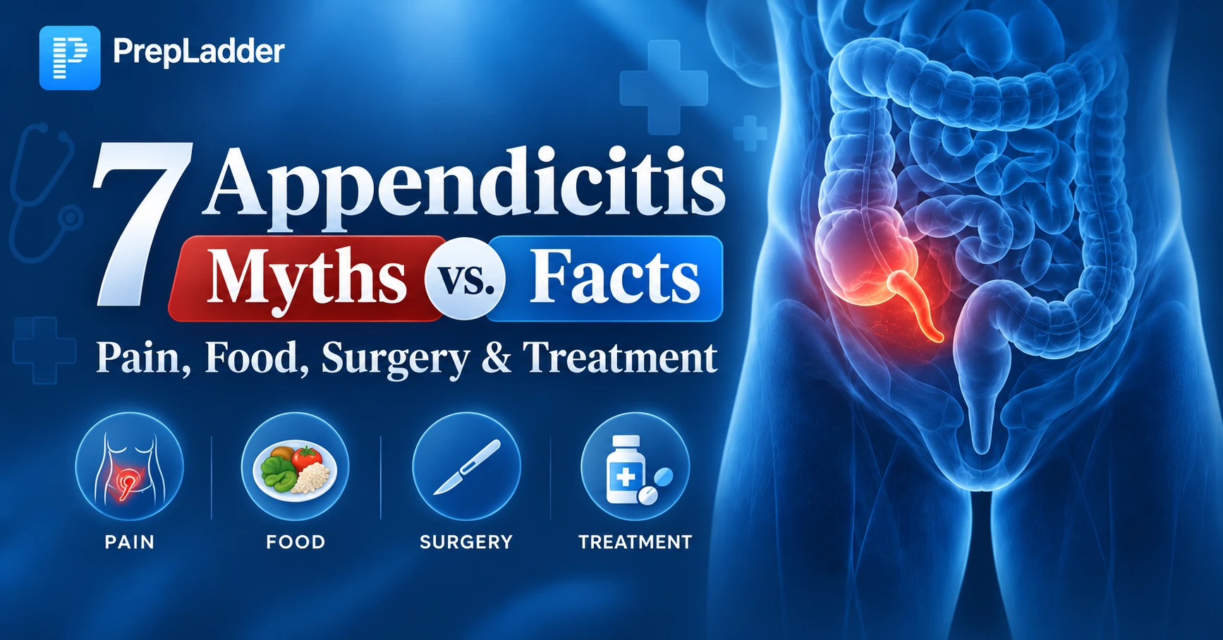 7 Appendicitis Myths vs Facts